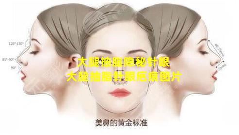 大腿抽脂隐秘针眼 大腿抽脂针眼疤痕图片